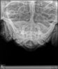 03-131-15 Darth X-ray b.jpg